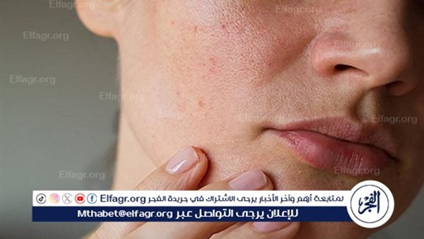 روتين العناية بالبشرة في الشتاء: سر الحفاظ على بشرة ناعمة ومشرقة